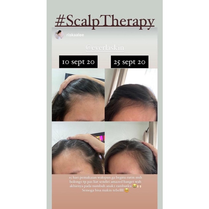 Everlaskin Scalp Therapy Natural Vegan Water-Based Hair Tonic 100 ml