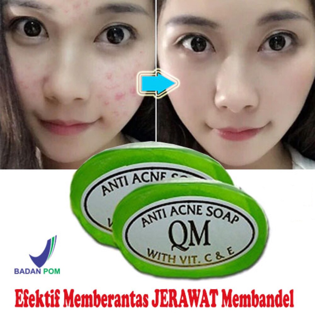 Sabun QM Anti Acne Ampuh Menghilangkan Jerawat dan Flek - 50gr Original BPOM