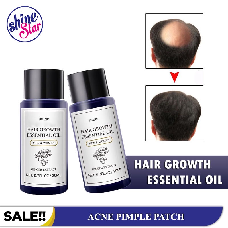 SHINE STAR - Hair Growth Essential Oil Hair Treatment Anti Hair Loss / Hair Tonic Obat Anti Rontok dan Botak