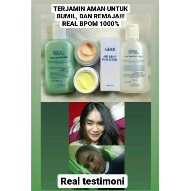 Primaderma acne glow (mencerahkan wajah)