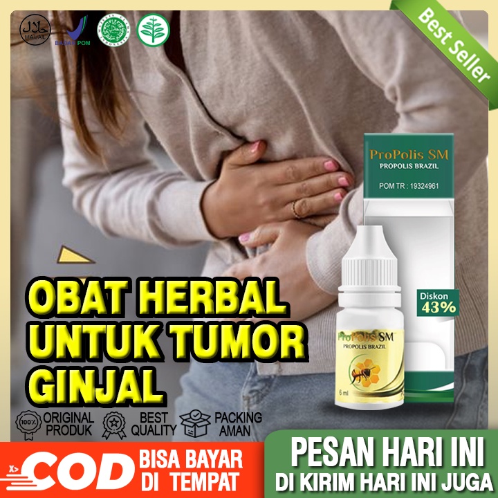 Obat Penyakit Tumor Ginjal, Tumor Jinak Dan Ganas- Propolis SM