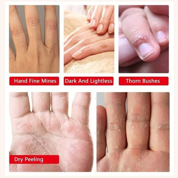 Hand Mask Exfoliating Removal Dead Skin Collagen Masker Tangan