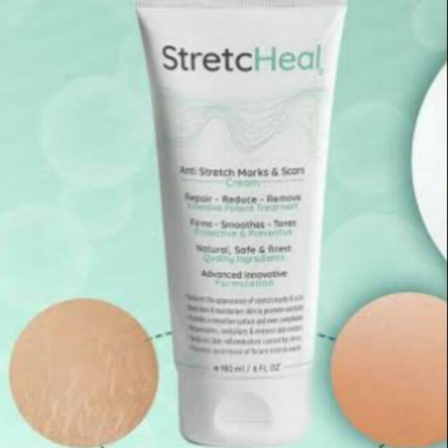 stretcheal cream