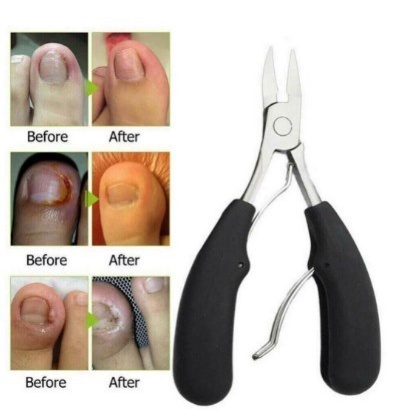 

Vip clippers Gunting kuku cantengan