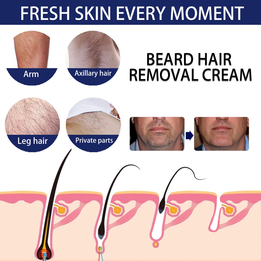 Krim Penghilang Bulu Perontok Bulu Pria Kemaluan Ketiak Waxing Tangan Kaki Kumis Kemaluan Permanen-60ml