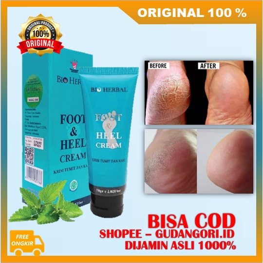 Cream Kaki Pecah-pecah Dan Kering Ampuh BPOM ORIGINAL