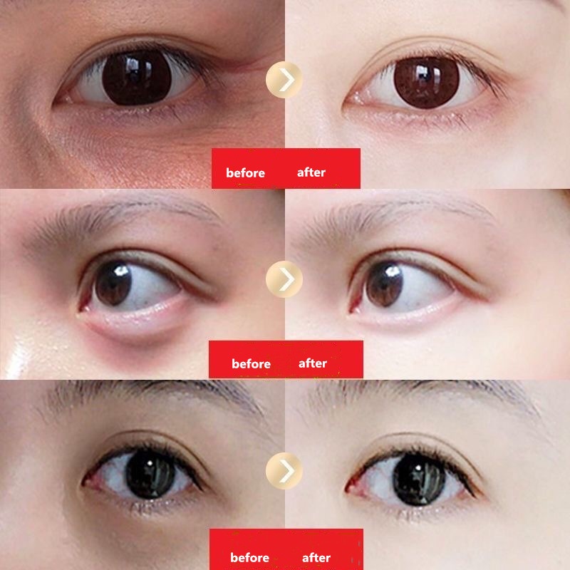 Krim Mata Eye cream Krim Mata Peptida Menyamarkan garis halus dan lingkaran hitam 30g Anti penuaan Menghilangkan lingkaran hitam dan kerutan menghilangkan kantung mata Mengencangkan kulit di sekitar mata