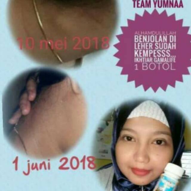 GAMAT EMAS MAHKOTA kemasan br dr Gamat emas tripang MSI, 100% GAMAT dari DASAR LAUT