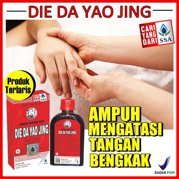 Jual Obat Bengkak Keseleo Pada Tangan Akibat Jatuh Paling Ampuh Aman ...