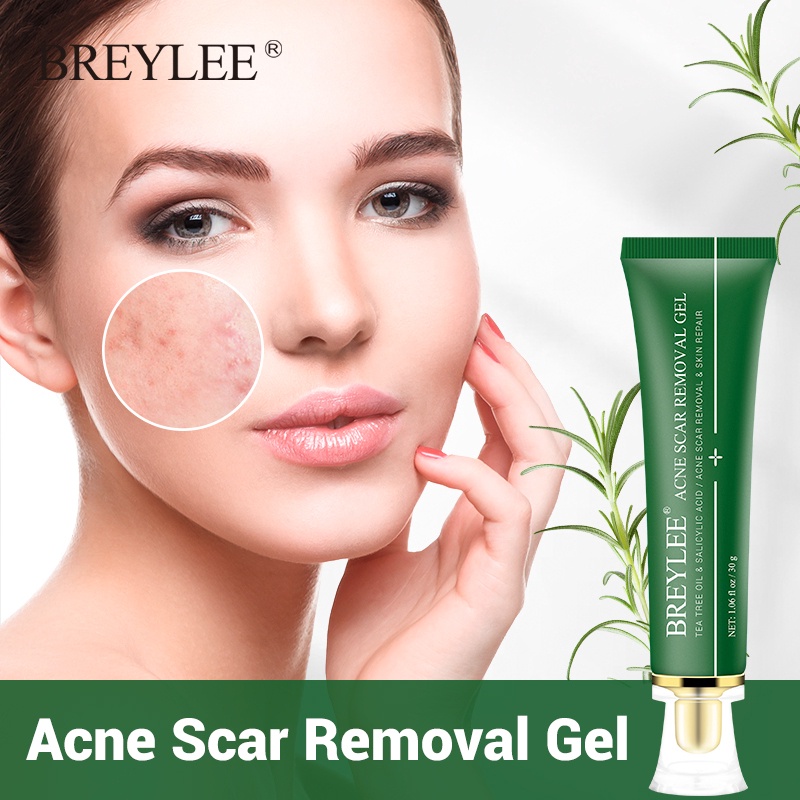 *OR* BREYLEE GEL PENGHILANG JERAWAT BEKAS LUKA 30G ACNE SCAR REMOVAL GEL& PEMUTIH KULIT