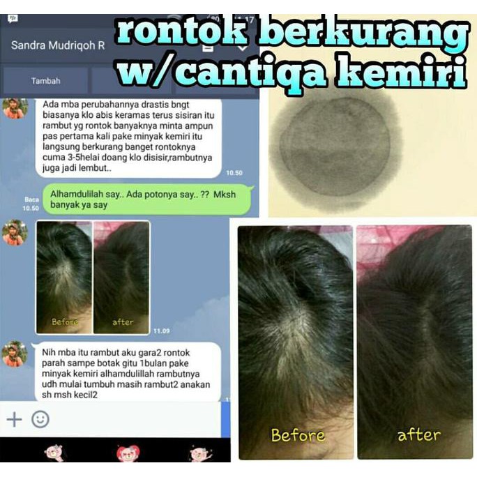 UPDATE AMPUH ATASI RAMBUT RONTOK HIJABER - PAKET CANTIQA KEMIRI 100% ORIGINAL PERAWATAN RAMBUT PROMO