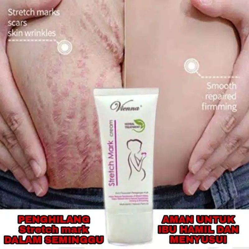 [COD] Penghilang Selulit Perut Paha Lengan Stretch Mark Lipatan Garis Guratan dalam 2 Minggu Vienna