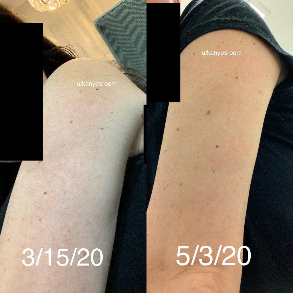 Cerave Sa Cream For Rough Bumpy Skin 120z 340gr Salicylic Acid Cream Shopee Indonesia