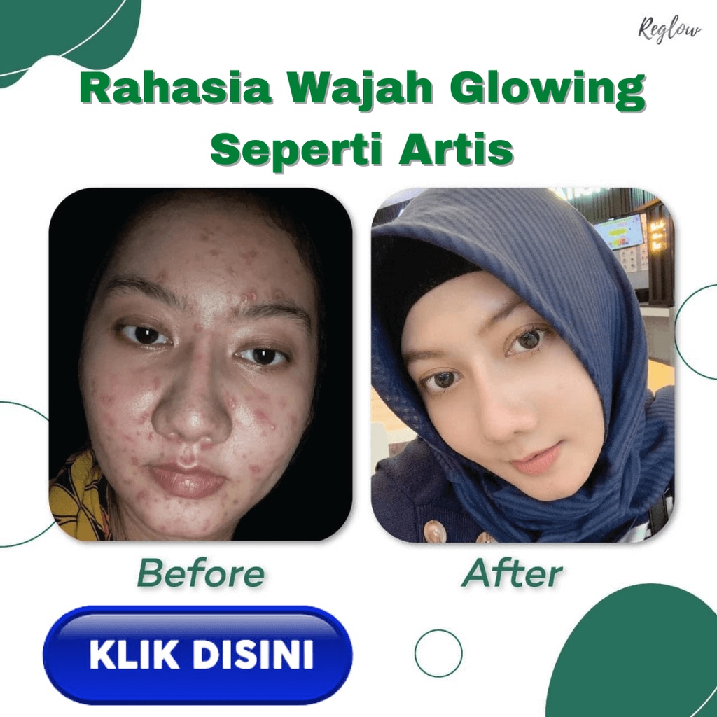 Reglow Skincare Original dr. Shindy Putri Bpom Paket Glowing Skin Treatment