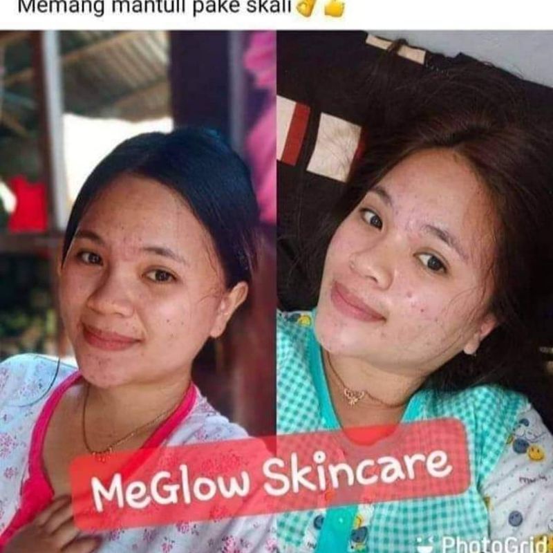 CREAM MEGLOW SKINCARE