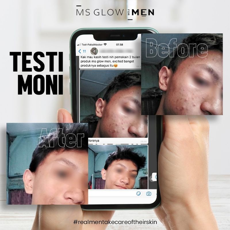 MS GLOW FOR MEN PAKET LENGKAP KOMPLIT MENGHILANGKAN JERAWAT BOPENG DAN MENCERAHKAN WAJAH BPOM ORIGINAL-1