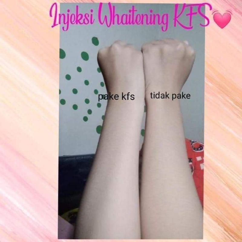 INJEKSI WHITENING KFS /ISI 2 /AMPUH 7-14 HARI LANGSING TERLIHAT