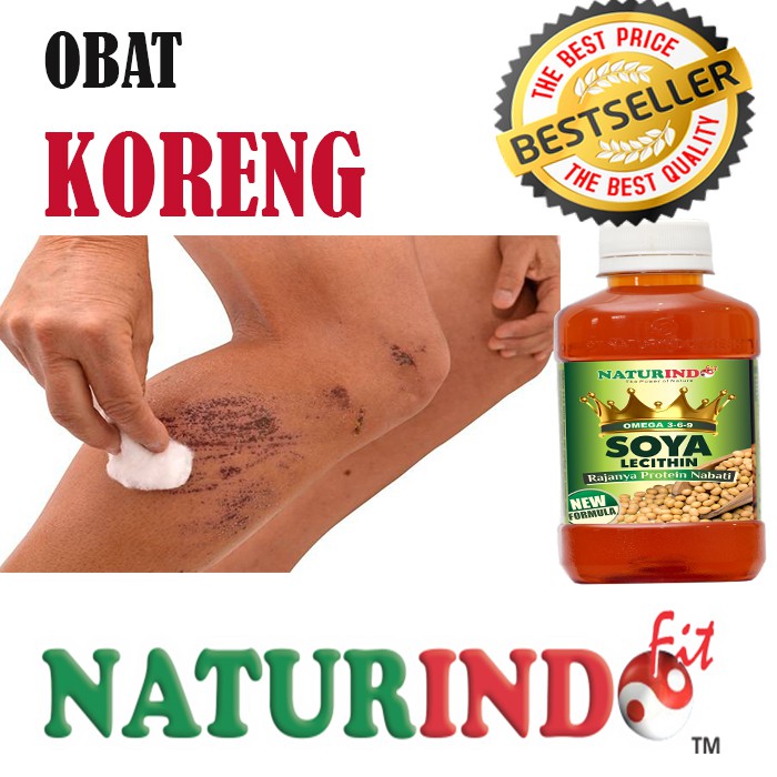 OBAT KORENG KULIT MENGHITAM PENGHILANG BEKAS LUKA KORENGAN GATAL BOPENG PALING AMPUH NATURINDO COD