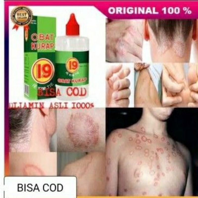 OBAT KURAP CAP 19, MENGOBATI PANU, KADAS, KURAP, JAMUR
