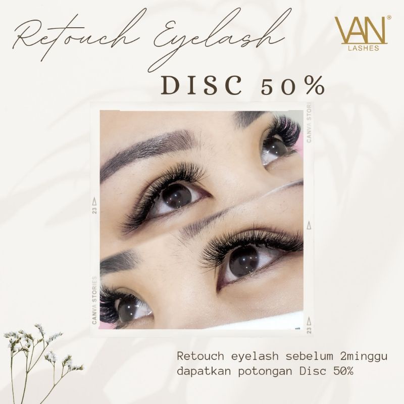 TREATMENT EYELASH EXTENSION BY VANSULAMALIS