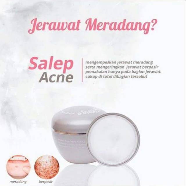 Ms glow Salep Acne