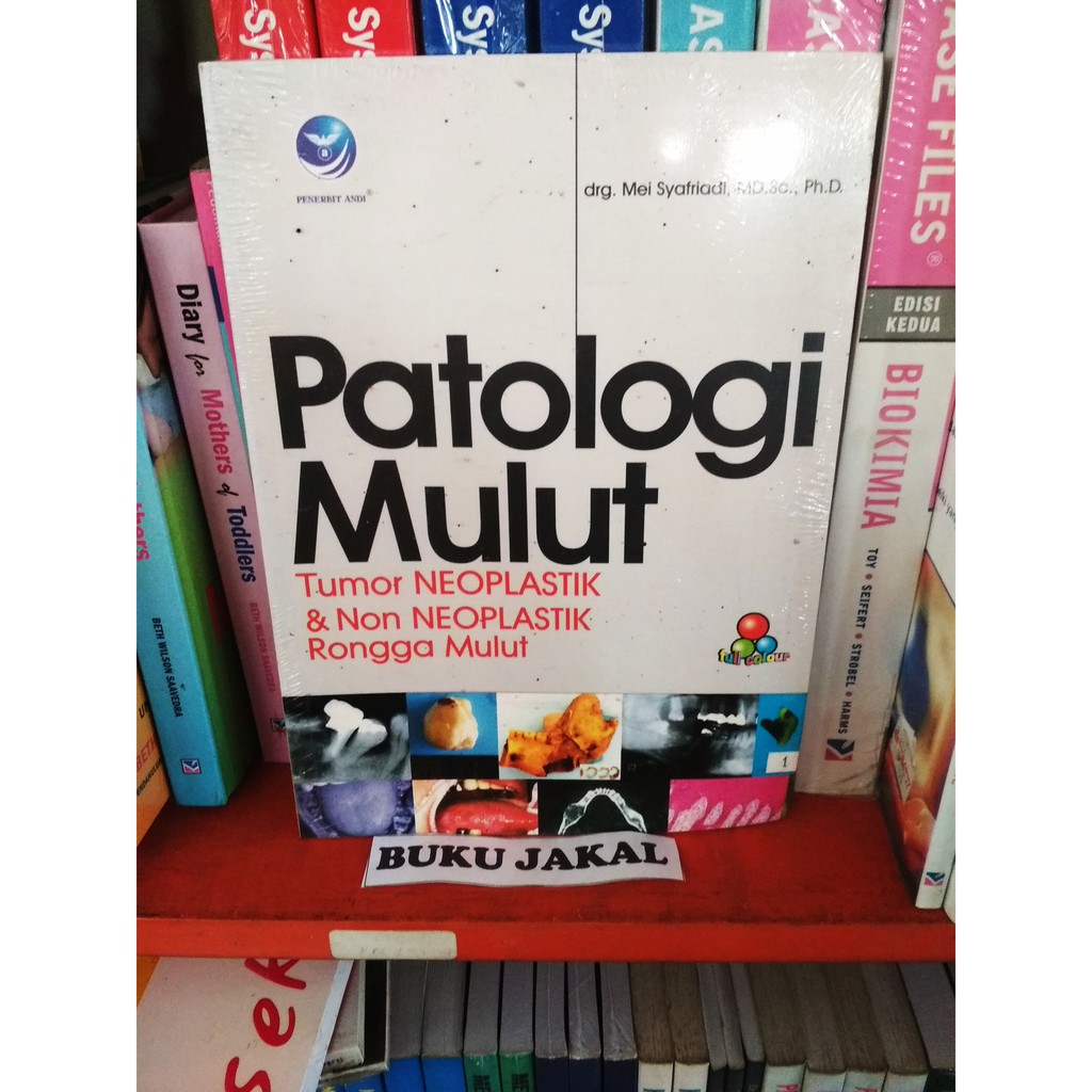 

BUKU PATOLOGI MULUT TUMOR NEOPLASTIK DAN NON NEOPLASTIK RONGGA MULUT k