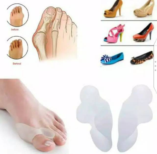 Ready Bunion Pemisah Korektor Jari Jempol Kaki Hallux  Valgus