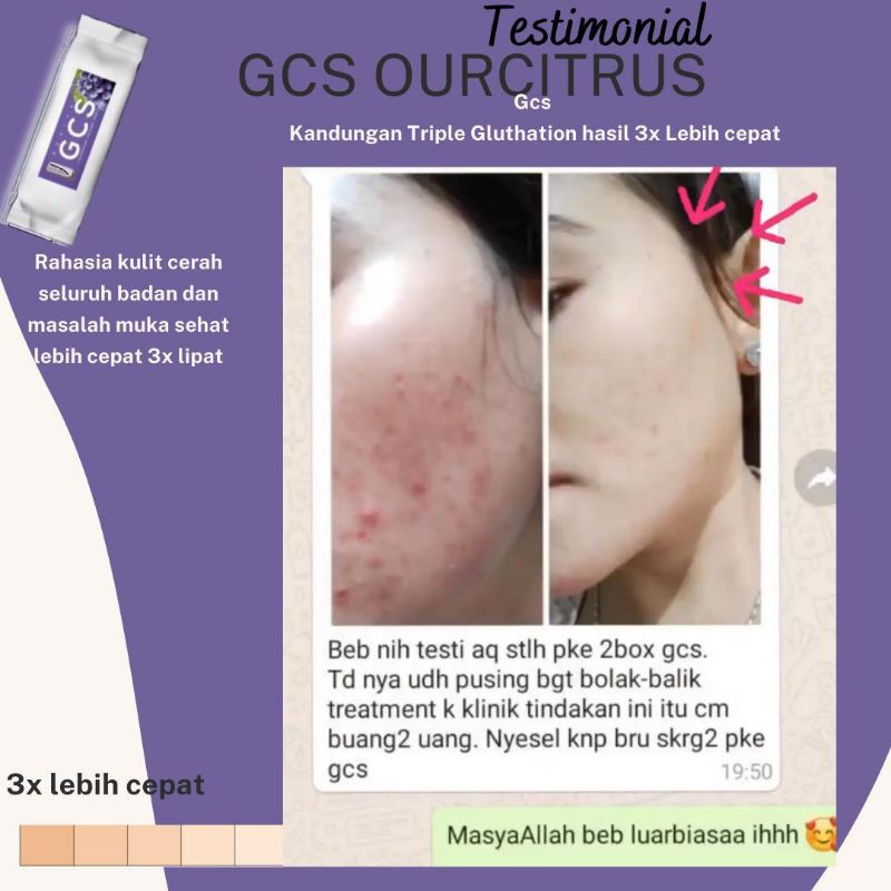 HOT PROMO  GCS REVIVAR by ourcitrus 100% original - Minuman Pemutih kulit tubuh - atasi jerawat