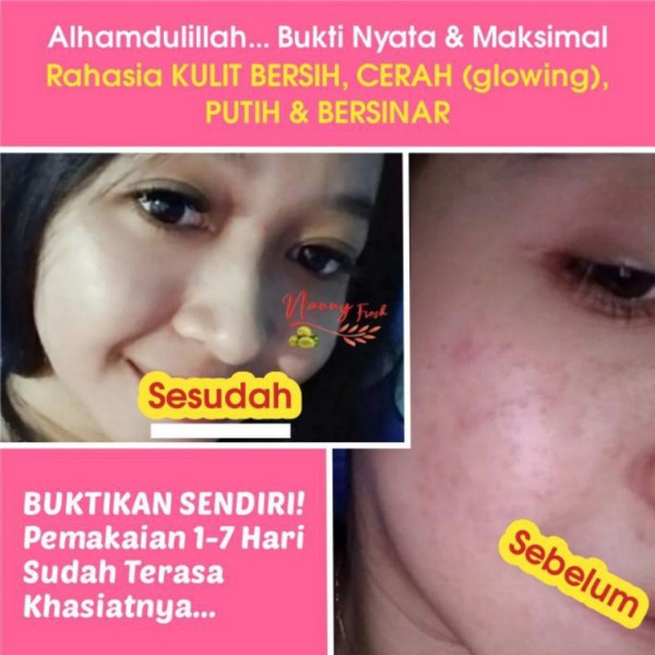 ✨COD✨NANNY FRES sabun nanny fres sabun kedas beauty sabun obat jerawat collagen pemutih kulit wajah