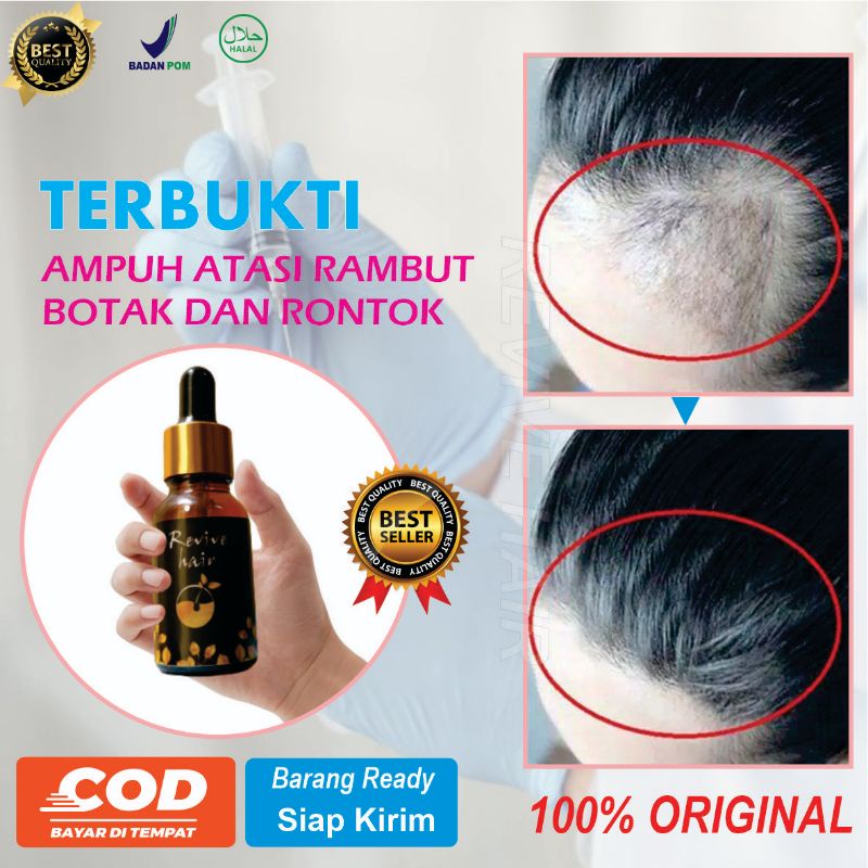 Serum Penumbuh Rambut &amp; Pemanjang Rambut Tercepat  No1 Di Indonesia, Hair Tonic, Penumbuh Rambut, Alis, Jenggot, Jambang, Bulu Dada Penebal Rambut Bayi &amp; Dewasa, Brewok, Kumis, Jambang, Janggut, Alis