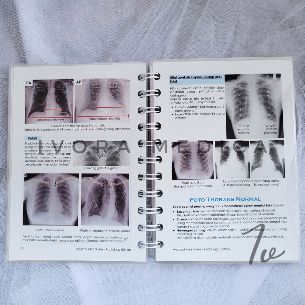 MMN | Medical Mini Notes - Radiology | MMN Radiologi-4