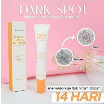 DARK SPOT SERUM MS GLOW // MS GLOW DARK SPOT