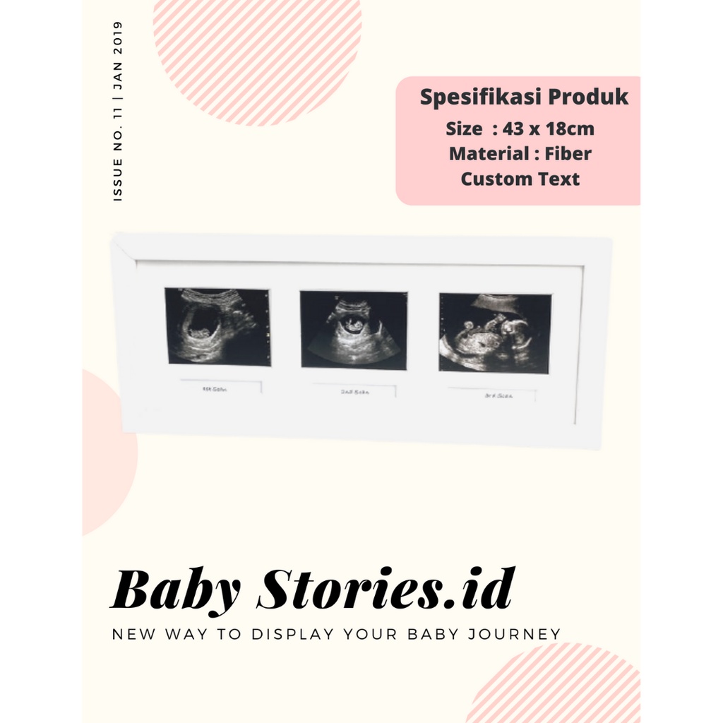 BINGKAI FOTO/ FRAME FOTO BAYI USG CUSTOM UNIK 3 FOTO WHITE