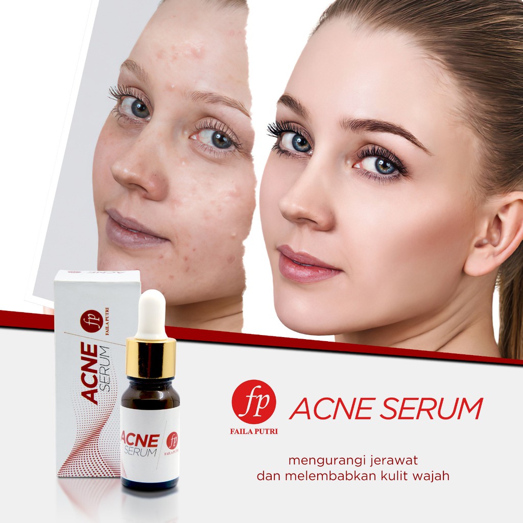 ACNE SERUM FP FAILA PUTRI BPOM  - Serum Anti Jerawat ORIGINAL FP