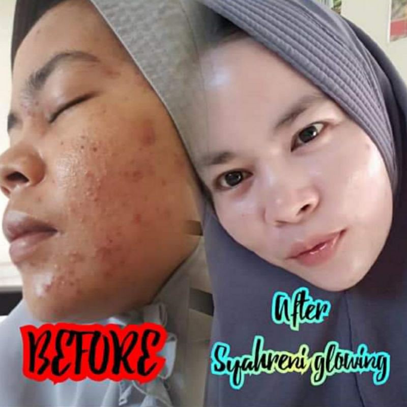 BISA COD BPOM PAKET LENGKAP SYAHRENI GLOWING SYR SYAHRAENI SET ORI PREMIUM KRIM SIANG WAJAH BEAUTY-3