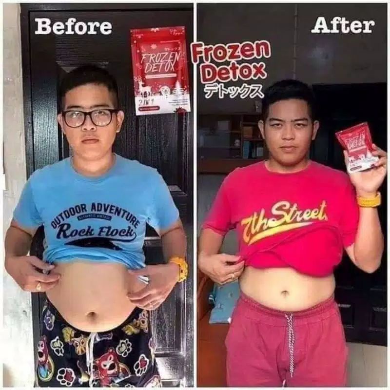 FROZEN DETOX 100% ORIGINAL THAILAND HALAL BARCODE GLUTA PELANGSING DIET 60 KAPSUL - JOJU COLLAGEN