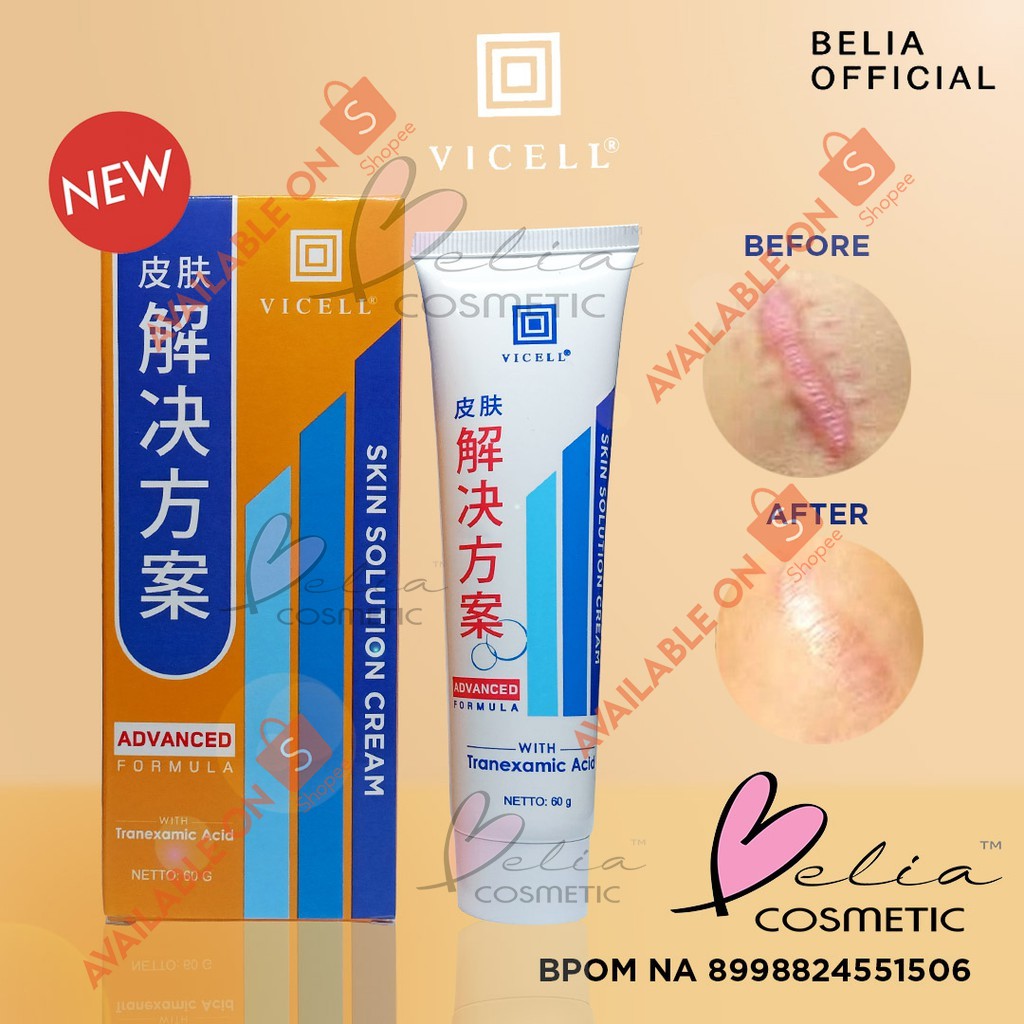 ❤ BELIA ❤ VICELL (✔️BPOM) Krim Penghilang Bekas Luka 60mL VICEL Hanasui