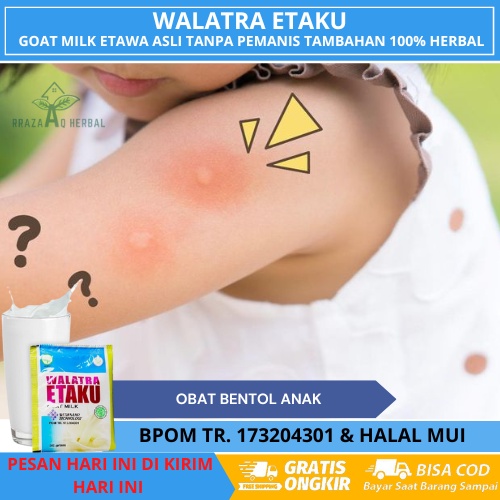 Obat Bentol Anak, Bentol Bentol Seluruh Tubuh, Obat Gatal Tubuh Anak, Obat Gatal Kulit, Obat Herbal 