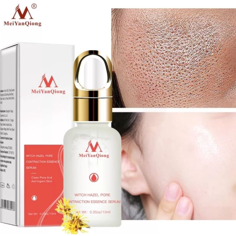 MEIYANQIONG SERUM ESSENCE KONTRAKSI PORI-PORI SERUM PENGECIL PORI-PORI-10ml