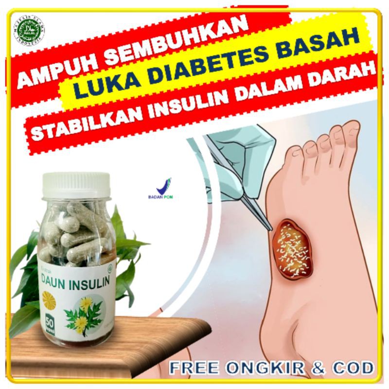 

Daun Insulin kapsul herbal obat diabetes kencing manis paket penyembuhan luka 4 botol