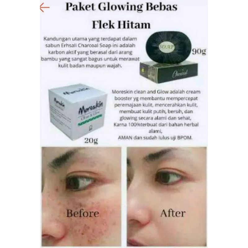 Paket Flek hitam aman BPOM