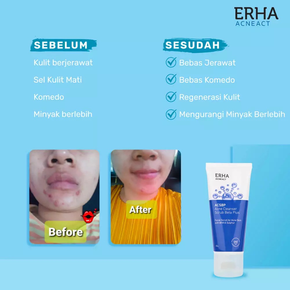 ERHA21 ERHA ACSBP Acne Cleanser Scrub Beta Plus 60gr