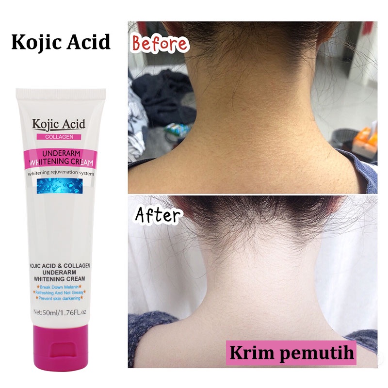 【Barang spot】pemutih mencerahkan, melembapkan, tubuh ketiak selangkanganCream Private Part Krim Pemutih 50ml Merah muda untuk bagian pribadi untuk menghilangkan melanin