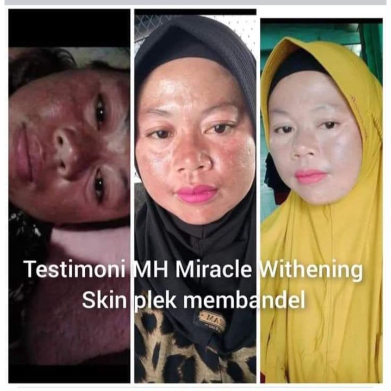 (FREE ONGKIR/COD)PAKET MURAH HEMAT MH MIRACLE ORI 100% BONUS KAPAS KECANTIKAN
