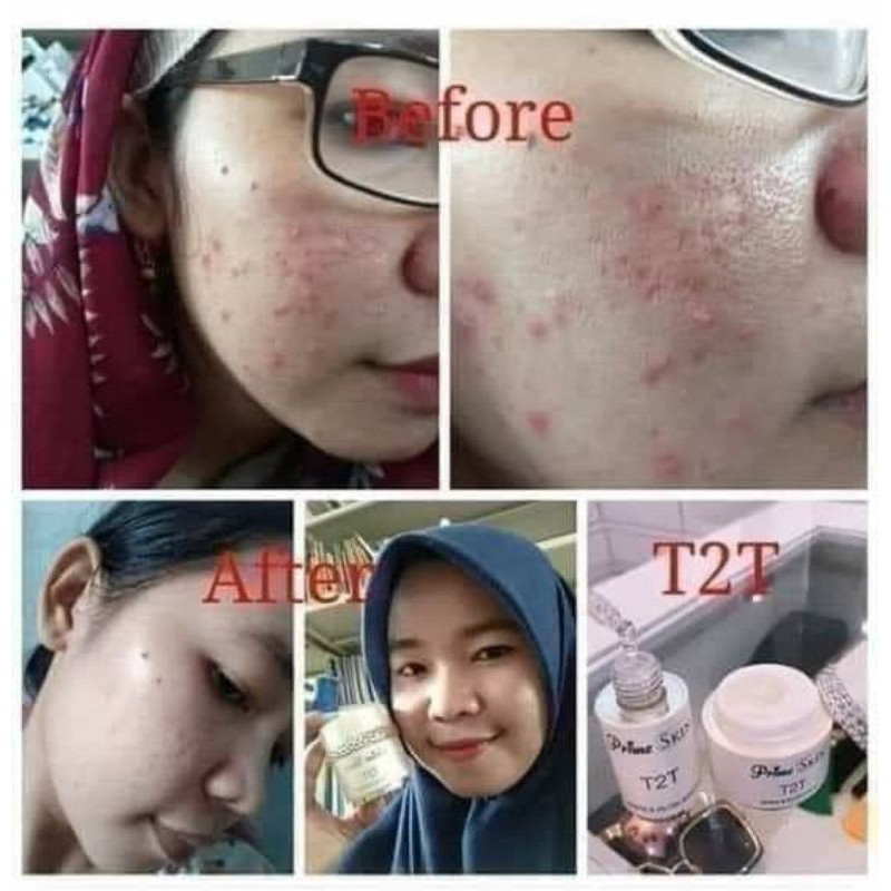 T2T Cream dan Serum HWI