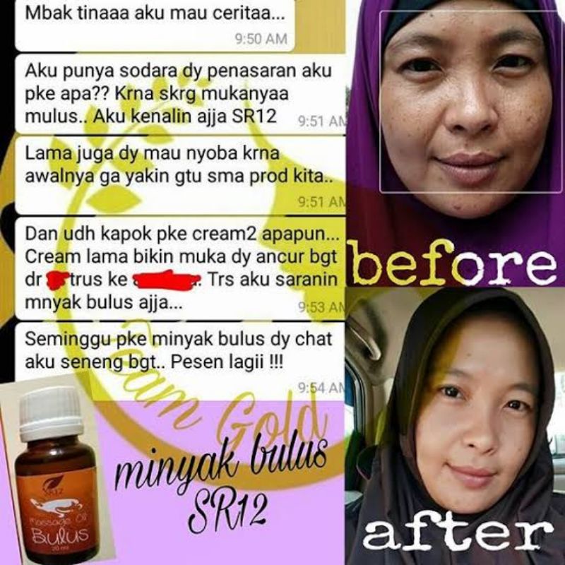 Paket Skincare SR12