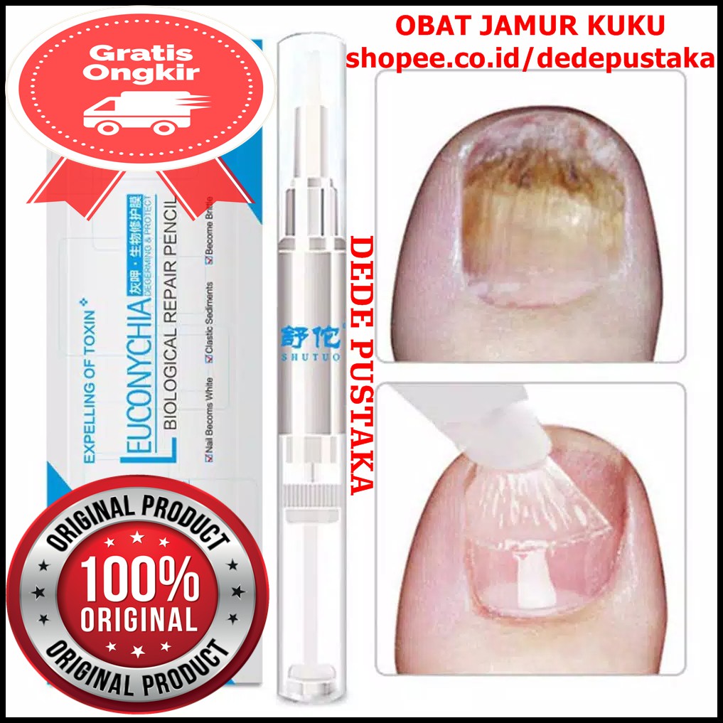 Jual Obat Jamur Kuku Indonesia Shopee Indonesia