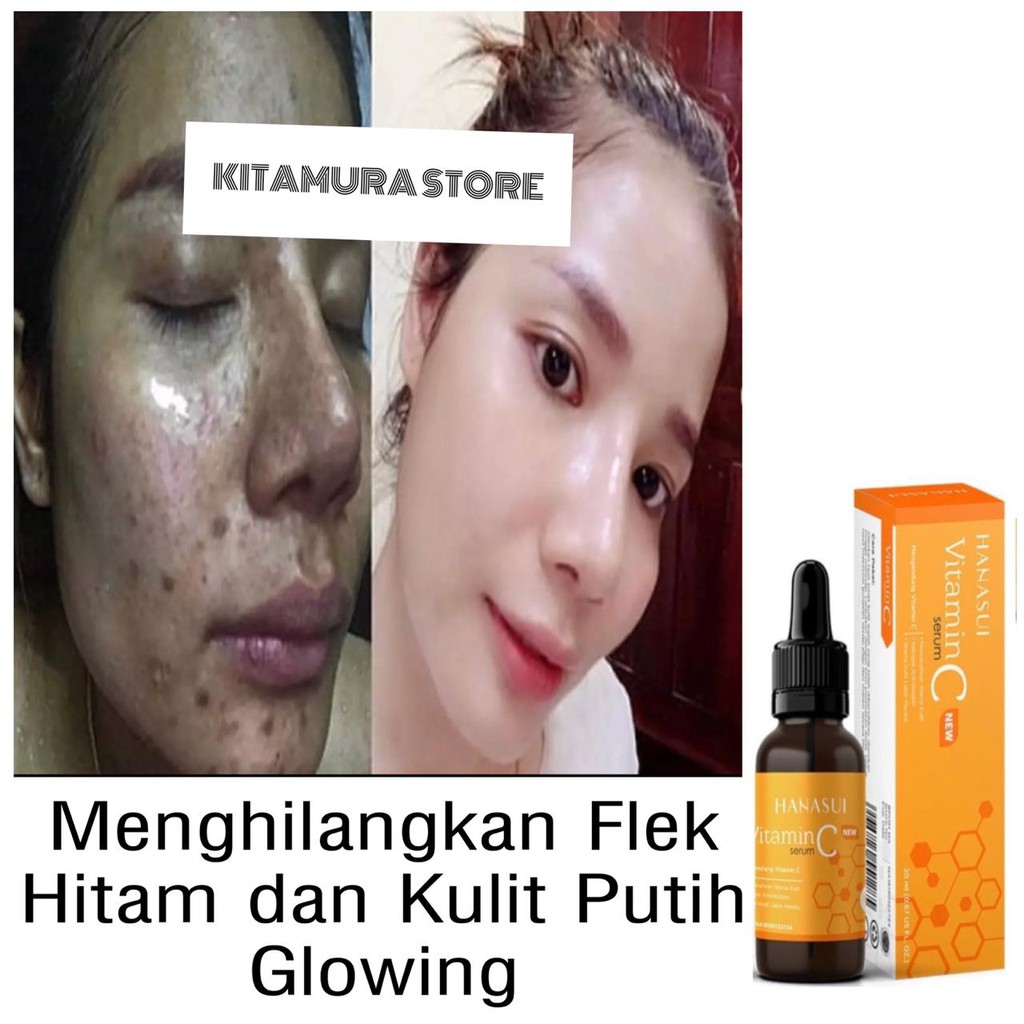 PEMUTIH WAJAH PENGHILANG FLEK HITAM DAN PENGGLOWING WAJAH 5X LEBIH CEPAT DALAM 3 HARI BPOM