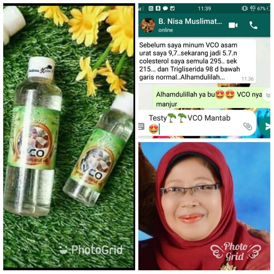 Virgin Coconut Oil Vco Obat Asam Urat Indonesia