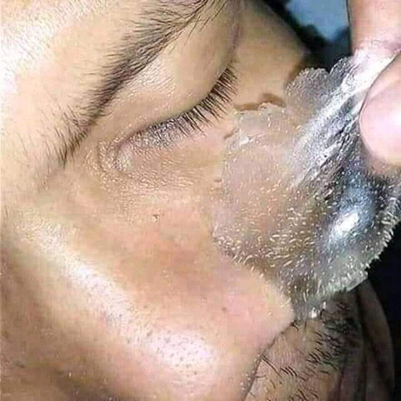 MASKER KOMEDO/PENGANGKAT KOMEDO